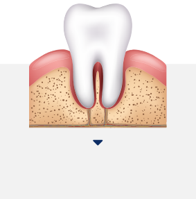 스케일링 아이콘