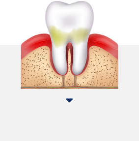 치근활택술 아이콘