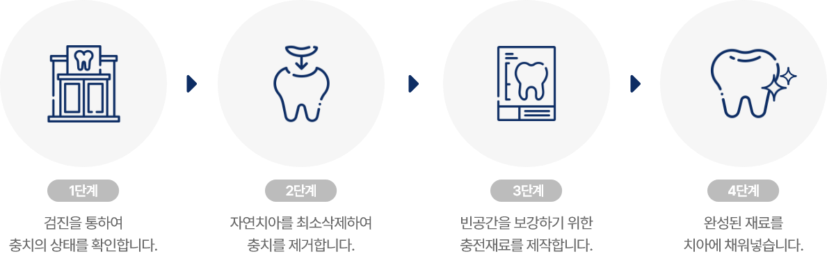 보존치료 시술과정 설명