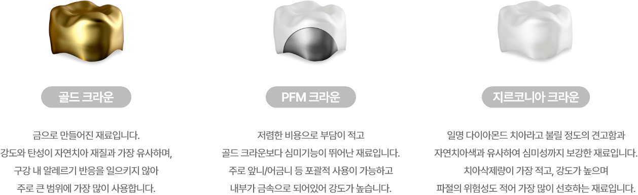 크라운 소재 설명