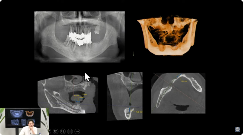 무엇이든 물어보세요 유튜브 바로가기